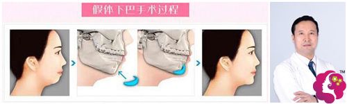 �Ͼ��ض������κ�����Ժ�����轺���°���������ԭ��ͼ