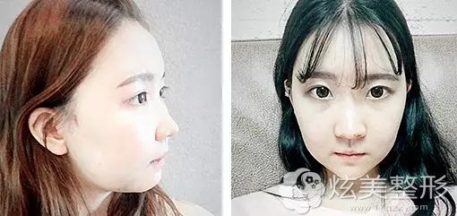�����沿��������������һ���»������ͽ׶�