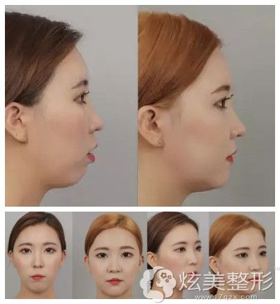 �ں���ID���沿����������ǰ����Ա�