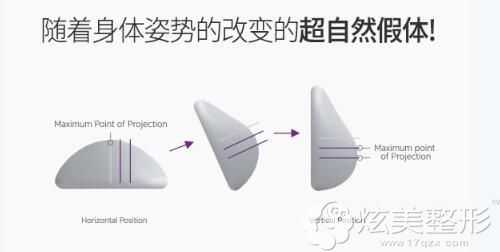 魔滴假体会随着移动自由变化形状 魔滴假体会随着移动自由变化形状