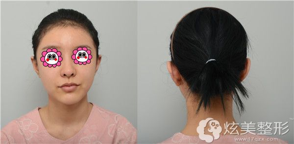 贴面耳明显的禾禾深受苦恼 贴面耳明显的禾禾深受苦恼