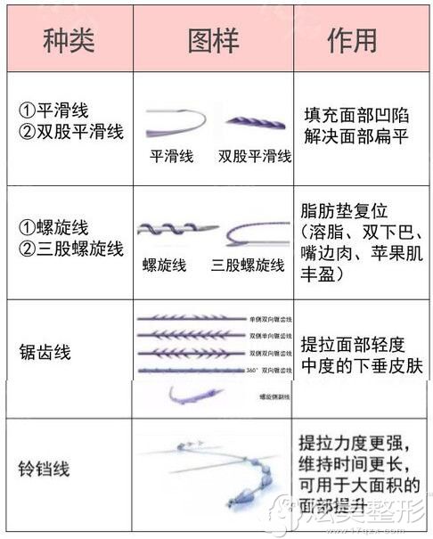 目前埋线提升所用的线材可分为可溶线和不可溶线两种 目前埋线提升所用的线材可分为可溶线和不可溶线两种
