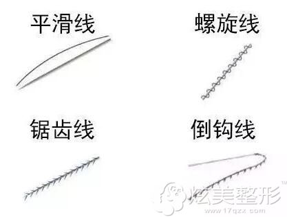 常用的埋线提升几种线材种类 常用的埋线提升几种线材种类