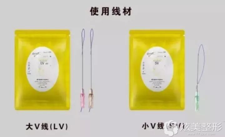 根据线材的粗细分为大V线和小V线 根据线材的粗细分为大V线和小V线