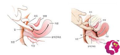 尹虎珠院长做后方膣圆盖术可以治疗子宫脱垂和阴道壁膨出 尹虎珠院长做后方膣圆盖术可以治疗子宫脱垂和阴道壁膨出