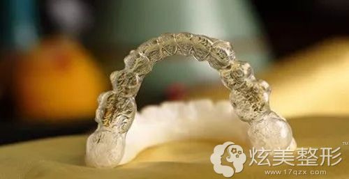 无托槽隐形矫正牙齿的材料 无托槽隐形矫正牙齿的材料