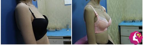 ���ݺ��������й���Բ�ͼ�������Ա�Ч��