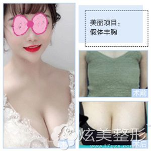 ����Ϊ������ѡ�����Ǻ������м���¡�ظ���