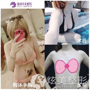 ��ģѡ���ݻ���������260cc�����ز���Ȼͦ��