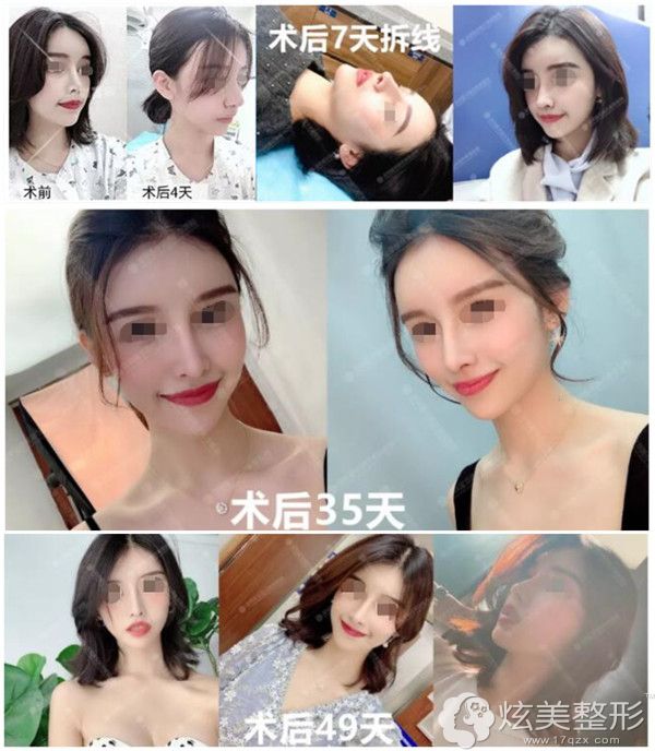 ��˹����ҽ����¡��ʧ���޸�����ָ�