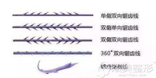 常见的4种线体类型 常见的4种线体类型