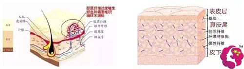 确定自己是疤痕体质是不能做阴唇整形的 确定自己是疤痕体质是不能做阴唇整形的