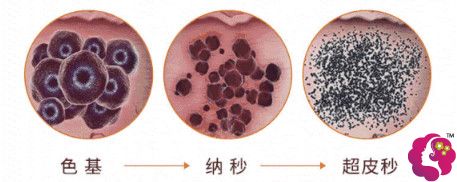 杭州薇琳整形做超皮秒对色素破坏能力更强 杭州薇琳整形做超皮秒对色素破坏能力更强