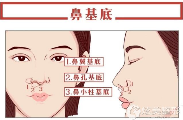 鼻基底的位置图 鼻基底的位置图