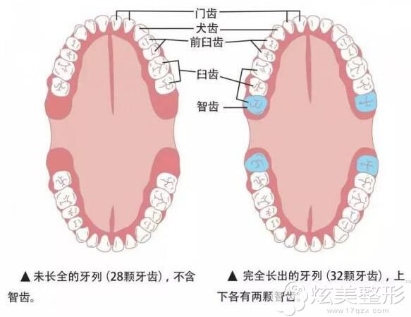 宋美佳医生讲什么是智齿 宋美佳医生讲什么是智齿