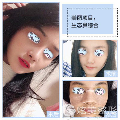 �ڸ����Ǻ���������¡������һ���±�����Ȼͦ��