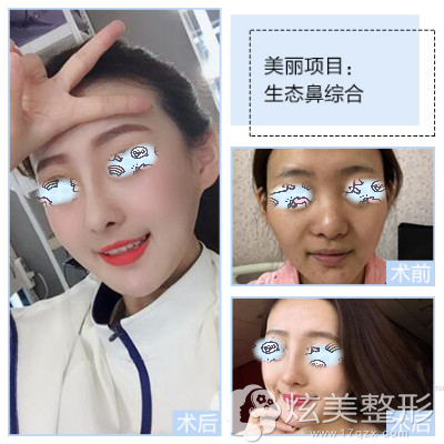 �����Ժ�����С����������¡������Ч��