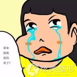 肋软骨隆鼻一个月鼻尖发白怎么修复 肋软骨隆鼻一个月鼻尖发白怎么修复