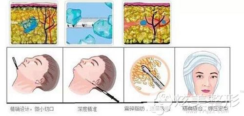ȧ����֬������ԭ��ͼ