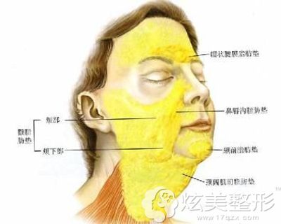 面部吸脂主要分出的三大区域 面部吸脂主要分出的三大区域