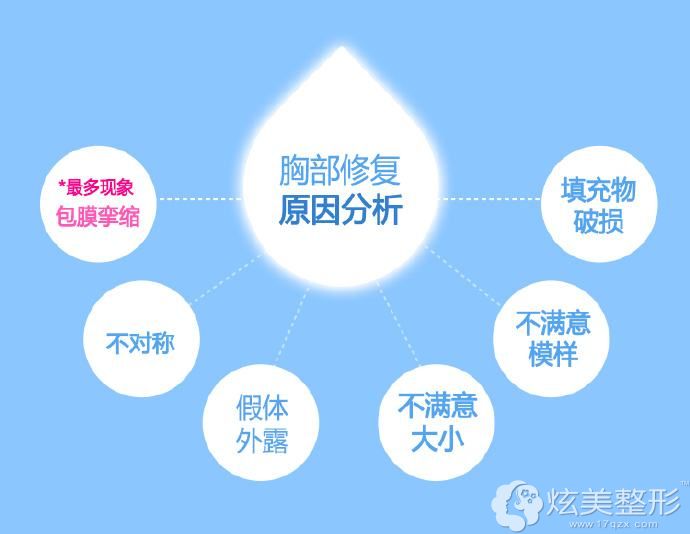隆胸失败需要修复的常见表现 隆胸失败需要修复的常见表现