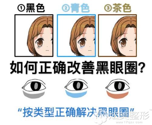 黑眼圈常见的三种类型 黑眼圈常见的三种类型