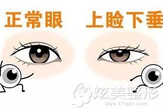 ������Ƥ�ɳ��´�Ӧ�����п�˫��Ƥ������ü����