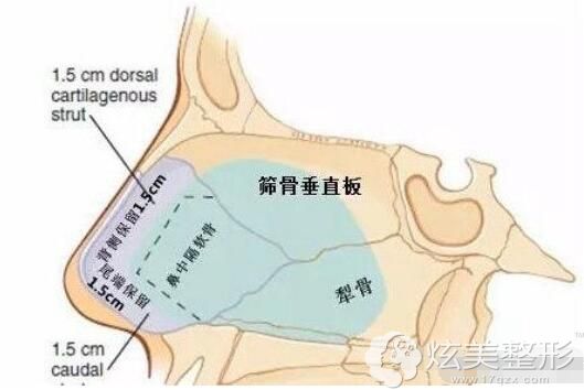 取出鼻中隔软骨软骨得有1-1.5cm宽的框架 取出鼻中隔软骨软骨得有1-1.5cm宽的框架