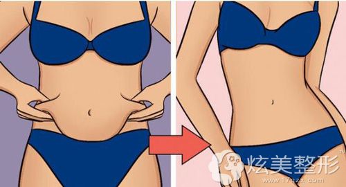 ���긹����֬�����Ч��