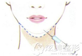 ��Ҫ�ر��̵��°Ϳ����ڹ轺���°ͺ�ע�䲣���������̶�