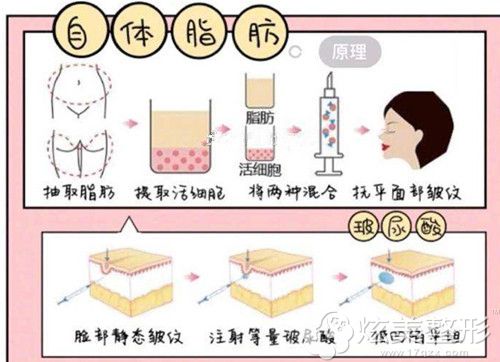 �̶Ƚ��ص��沿��͹��ƽ���Բ���֬�����߲�����������