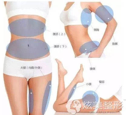 适合做冷冻溶脂的部位 适合做冷冻溶脂的部位