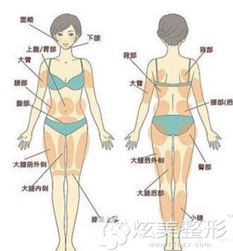 德新整形做水动力吸脂手术适合全身肥胖人群 德新整形做水动力吸脂手术适合全身肥胖人群