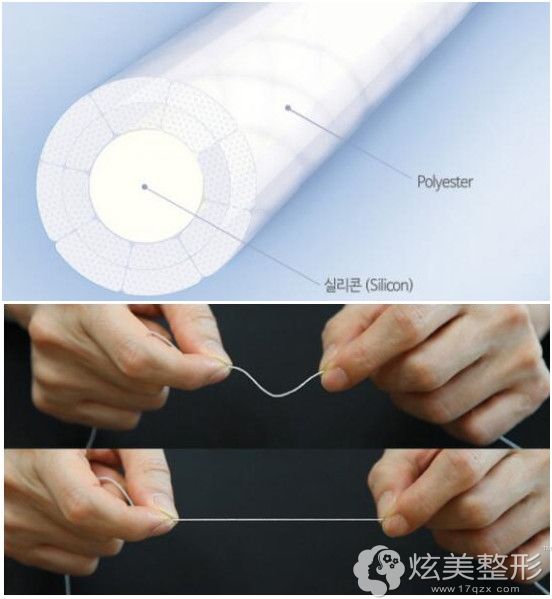 韩国the整形:主推金洙喆院长的非切开式埋线提升童颜 韩国the整形:主推金洙喆院长的非切开式埋线提升童颜