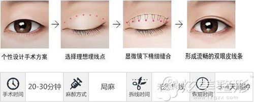 韦文奇医师做眼部整形手术过程 韦文奇医师做眼部整形手术过程