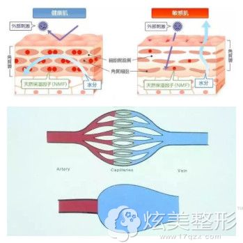 敏感肌出现红血丝的情况 敏感肌出现红血丝的情况
