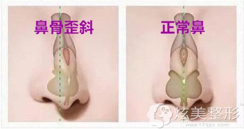 ����¡��ʧ��ȡ��������޸�,Ϊɶ�ҵ����عǲ��ܸ�����б