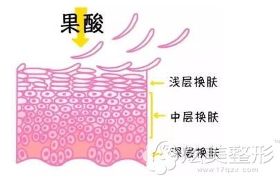 不同浓度的果酸有不同功效 不同浓度的果酸有不同功效
