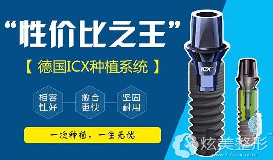 ICX德国种植体 ICX德国种植体