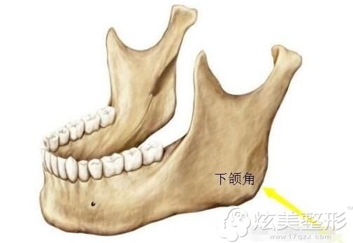 普通下颌角、长曲线下颌角、下颌角环切区别在哪