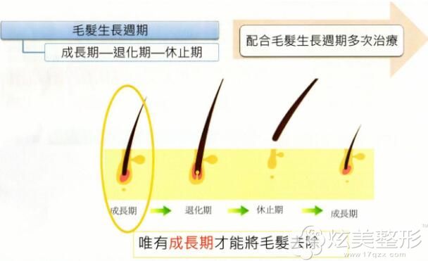 毛发的生长周期会影响脱毛效果 毛发的生长周期会影响脱毛效果