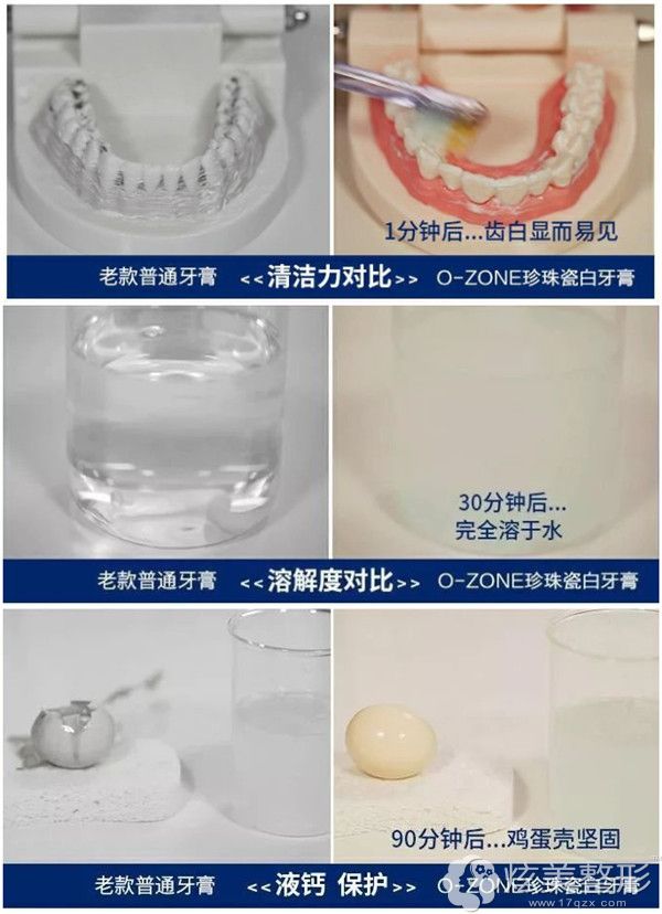 欧志姆牙膏各方面对比分析 欧志姆牙膏各方面对比分析