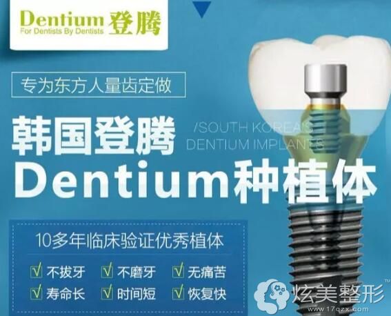 登腾种植牙体系 登腾种植牙体系