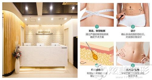 韩国贝缇莱茵整形吸脂术 韩国贝缇莱茵整形吸脂术