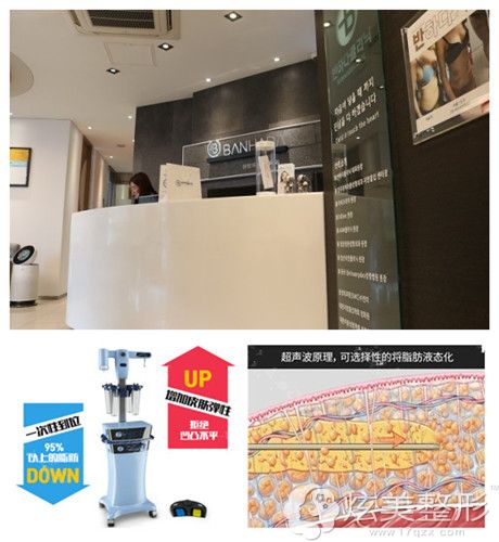 微塑整形采用的威塑吸脂手术 微塑整形采用的威塑吸脂手术