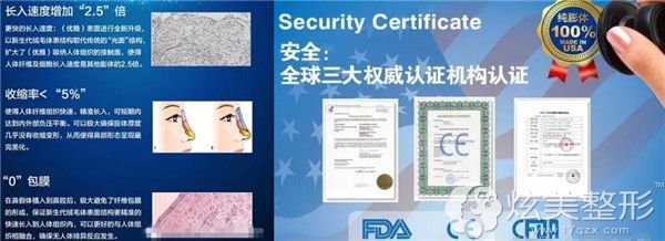 美国射极峰膨体是认证的假体品牌 美国射极峰膨体是认证的假体品牌