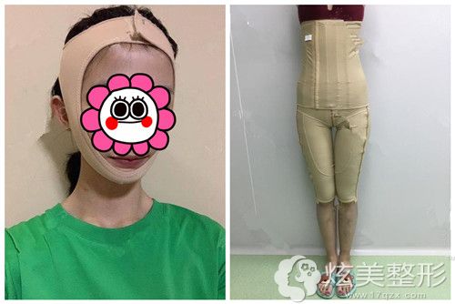 ��֬�����ͷ�׻���������