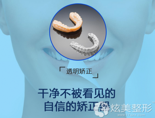隐形透明牙齿矫正器 隐形透明牙齿矫正器