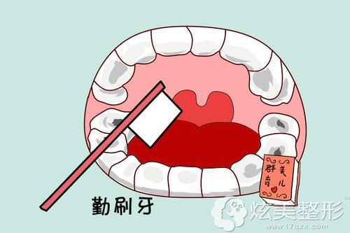 做完仿生冠后要做好术后注意事项 做完仿生冠后要做好术后注意事项