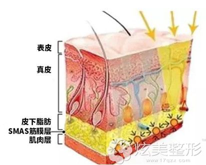 深蓝射频、热玛吉和热提拉作用的皮肤层不同 深蓝射频、热玛吉和热提拉作用的皮肤层不同